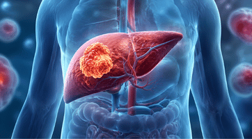 GI Oncology