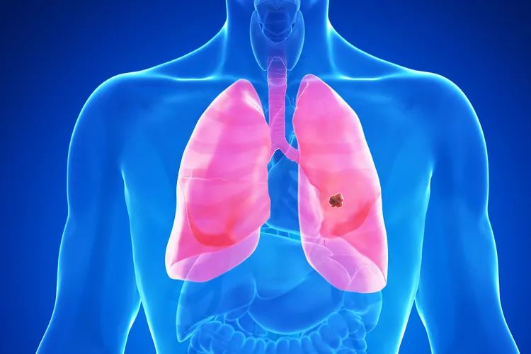 GI Oncology