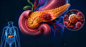 GI Oncology