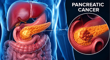 GI Oncology