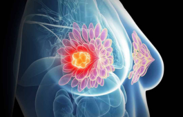 Breast and Chemoport Surgery