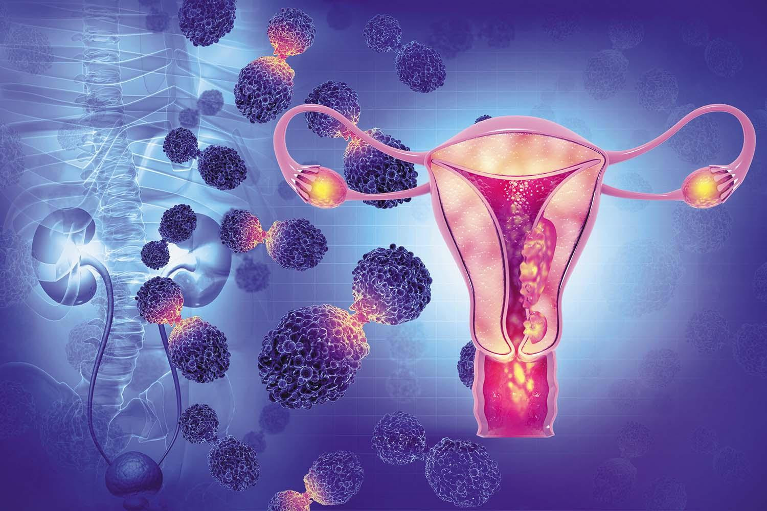 GI Oncology