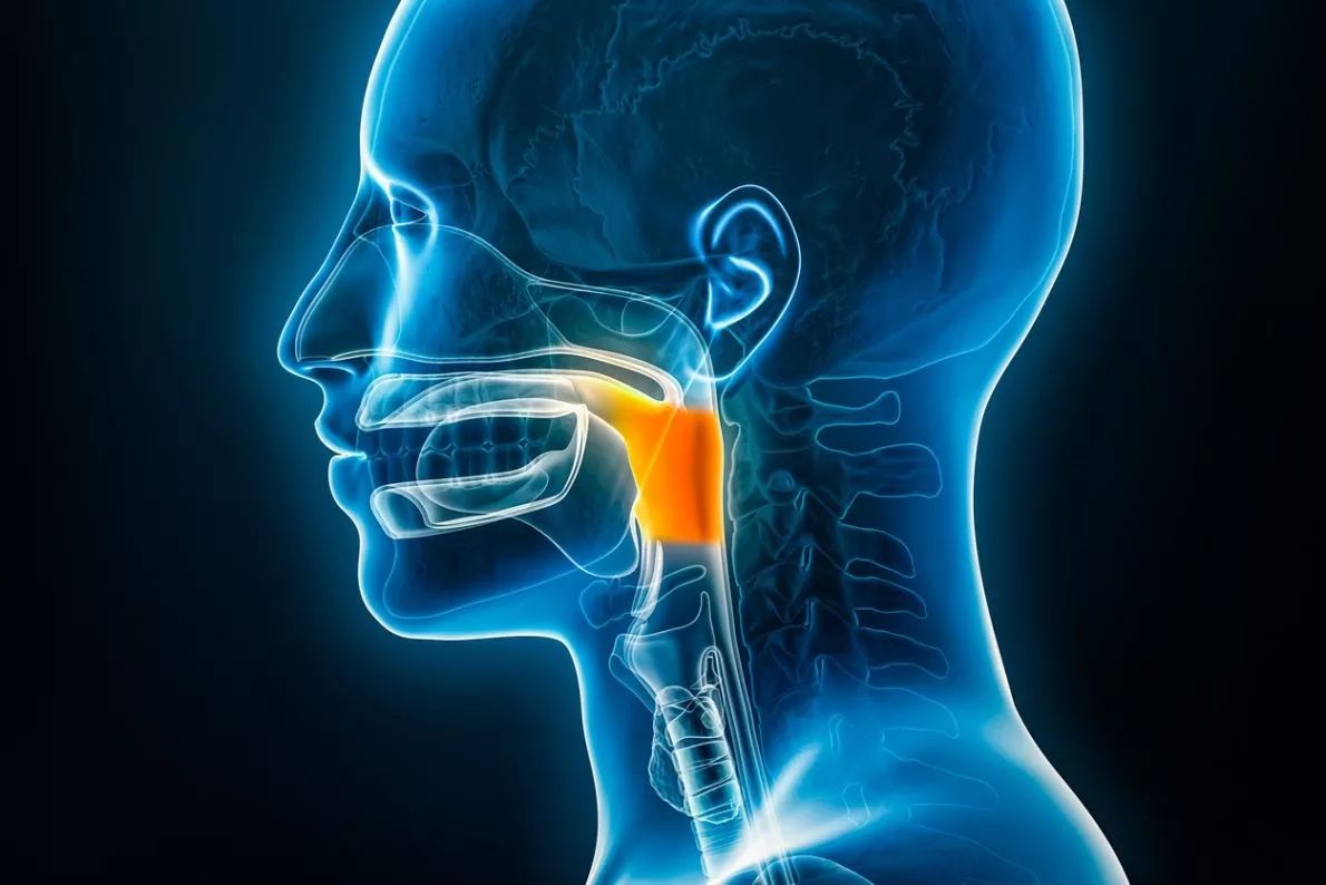 Head and Neck Cancer