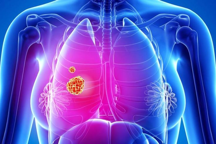 GI Oncology